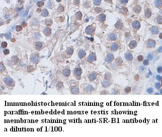 SCARB1 / SR-BI Antibody
