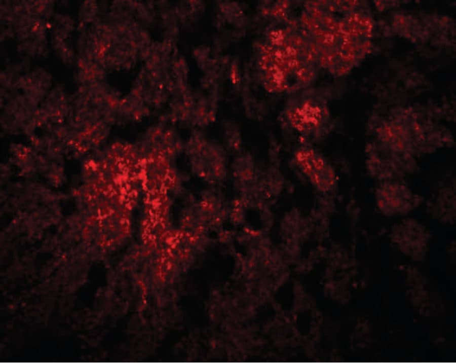 IHC-plus™ Polyclonal Rabbit anti-Human CCDC106 Antibody (IHC, IF, WB)