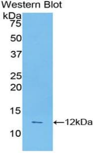 CASP4 / Caspase 4 Antibody (aa290-377, FITC)