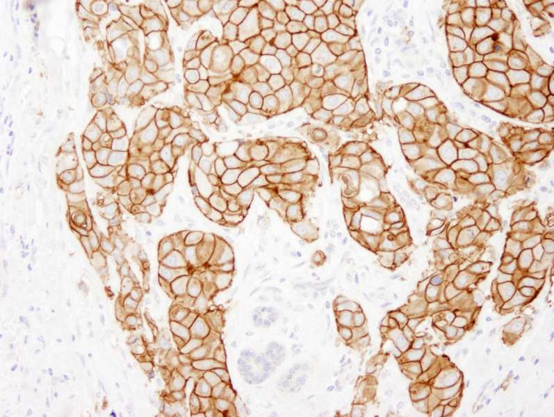 Polyclonal Rabbit anti-Human ERBB2 / HER2 Antibody (aa1200-C-term, IHC, IF)