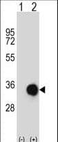 CASP6 / Caspase 6 Antibody (aa17-45)