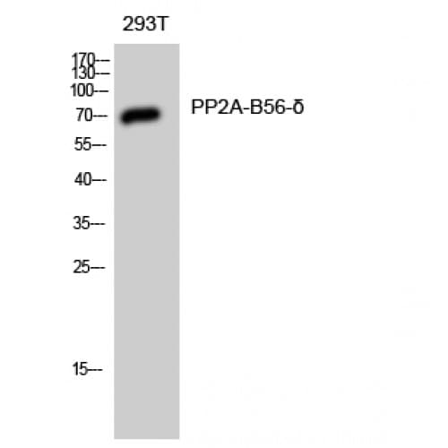 Polyclonal Rabbit anti-Human PPP2R5D Antibody (520-600 aa, C-terminal, IHC, WB)