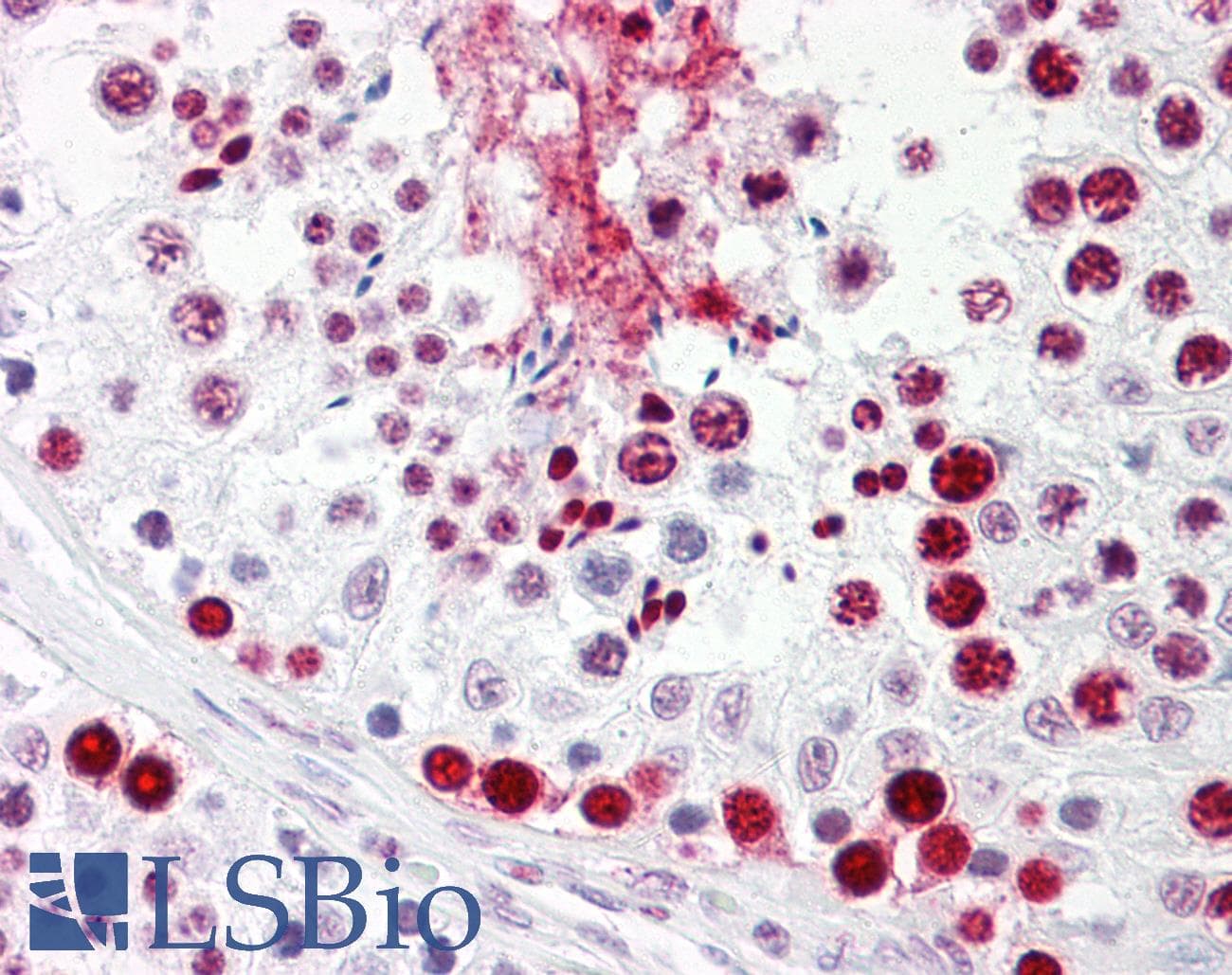 IHC-plus™ HNRNPL / hnRNP L Antibody (aa61-110)