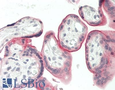 IHC-plus™ CD39 Antibody (aa38-307, clone 2B10)