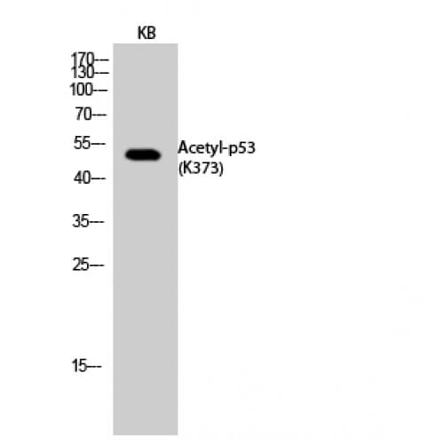 Polyclonal Rabbit anti-Human TP53 / p53 Antibody (acetylation site of K373., WB)