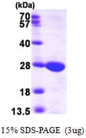 Human GUK1 / Guanylate Kinase 1 Protein (Recombinant His)
