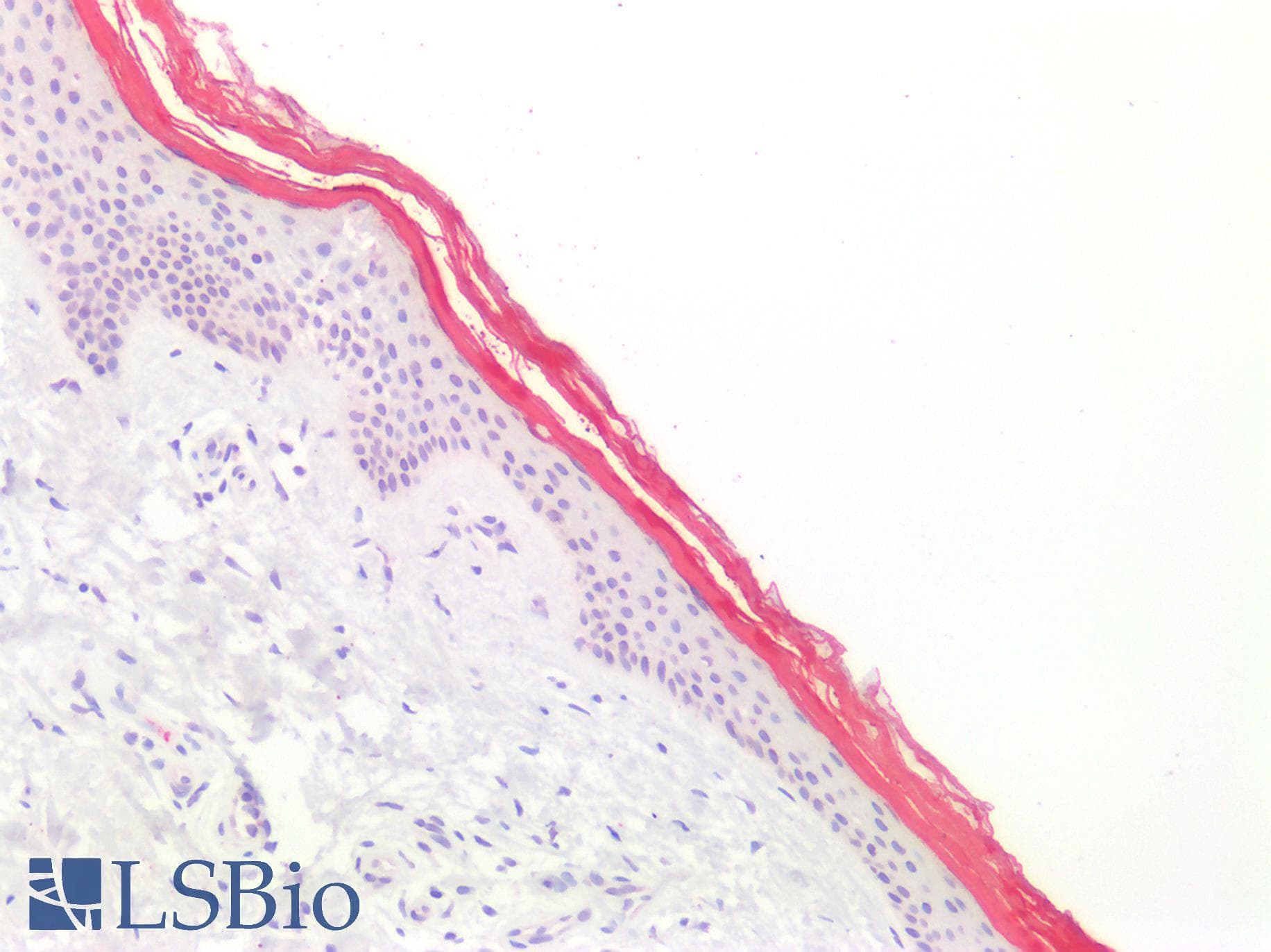 IHC-plus™ 5-Alpha Reductase / SRD5A1 Antibody
