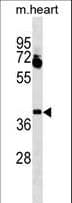 Polyclonal Rabbit anti-Human LBX1 Antibody (aa127-155, WB)