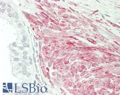 IHC-plus™ DES / Desmin Antibody