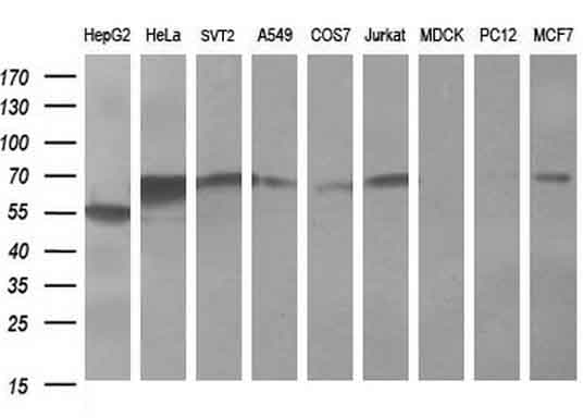 Monoclonal Mouse anti-Human FTCD / 58K Golgi Protein Antibody (clone OTI4B6, WB)