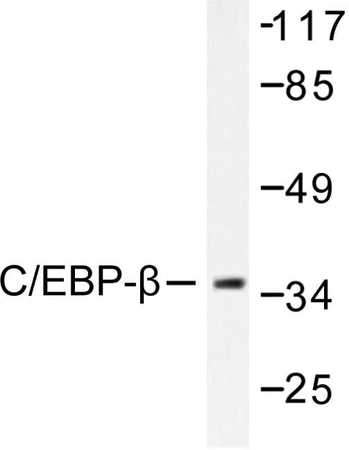 C/EBP Beta / CEBPB Antibody (Ser229)