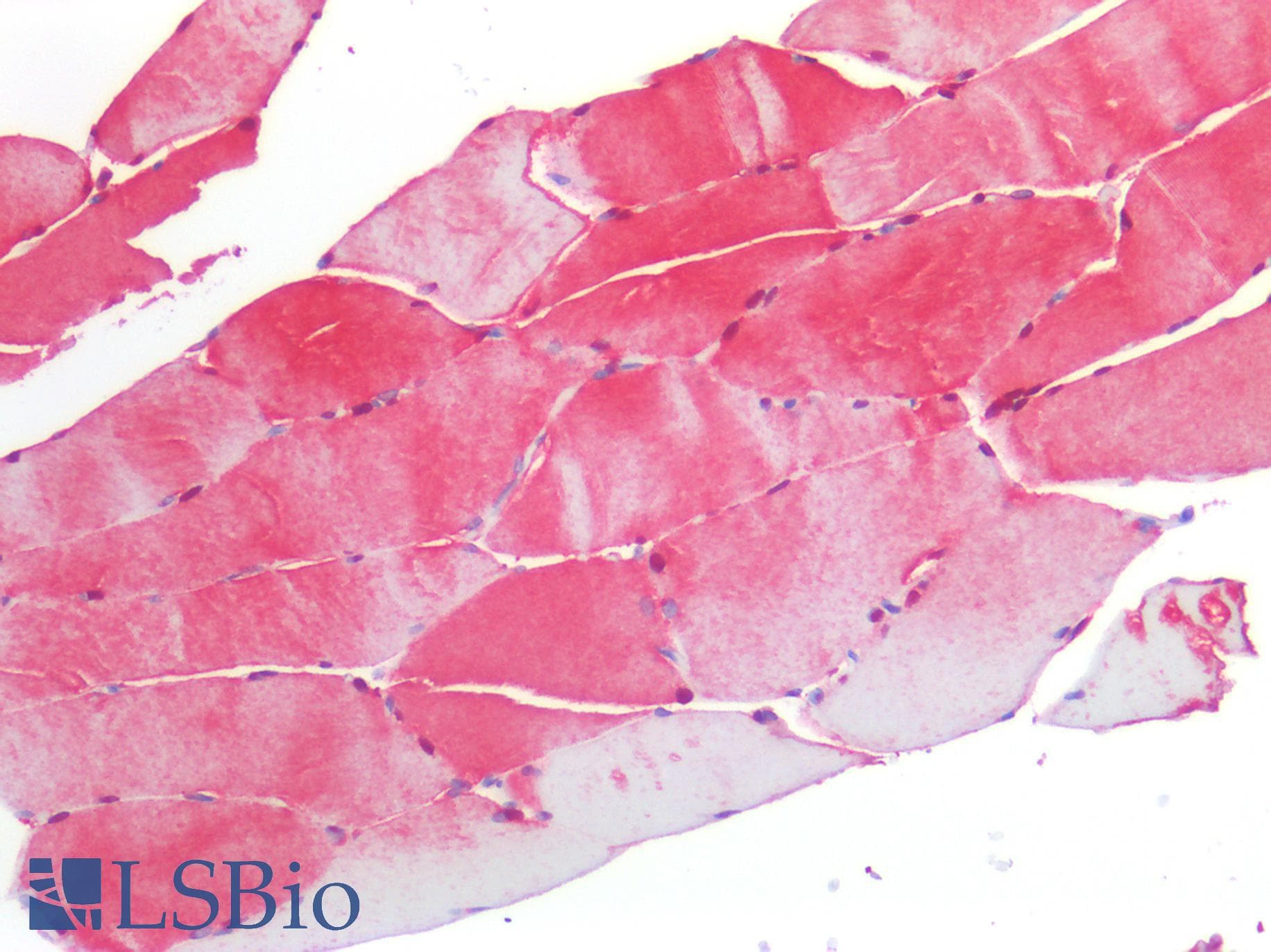 IHC-plus™ S100A1 / S100-A1 Antibody (Internal)