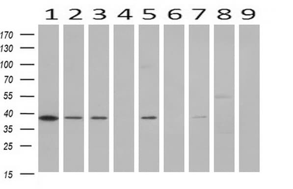 DNAJB1 / Hsp40 Antibody (clone OTI1E9)