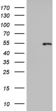 Monoclonal Mouse anti-Human KRT14 / CK14 / Cytokeratin 14 Antibody (clone OTI4A7, aa261-472, WB)