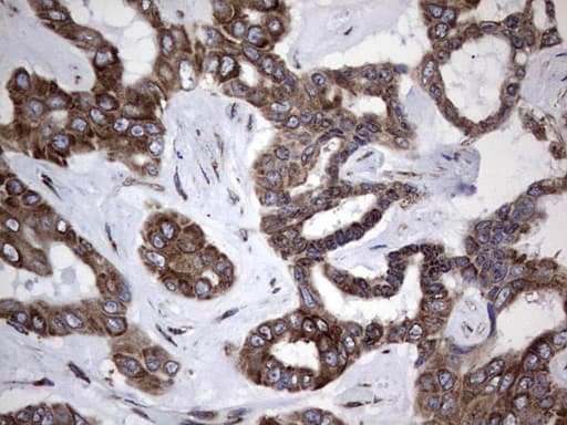MTDH / Metadherin Antibody (aa70-582, clone OTI1B6)