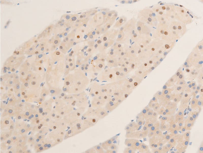 Polyclonal Rabbit anti-Human MYC / c-Myc Antibody (phospho-Ser62, IHC, IF, WB)