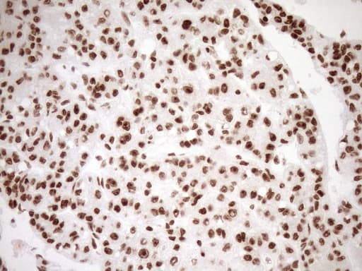 EXOSC1 / CSL4 Antibody (clone OTI1H9)