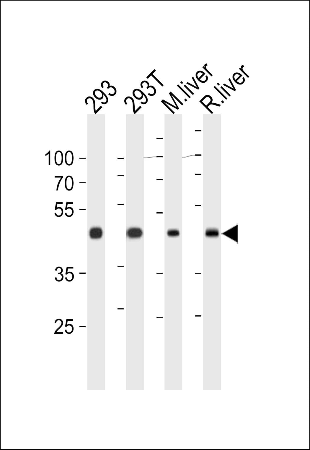 OAT Antibody (aa27-55)