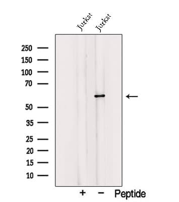 Polyclonal Rabbit anti-Human TRIM27 Antibody (WB)