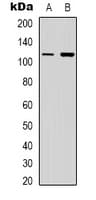 IHC-plus™ PIK3CG / PI3K Gamma Antibody (Internal)
