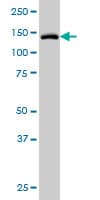 TYK2 Antibody (clone 6G12)