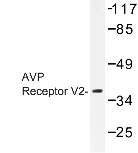 AVPR2 / V2R Antibody (Leu111)