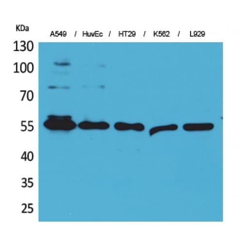 FSCN1 / Fascin Antibody (261-310 aa, Internal)