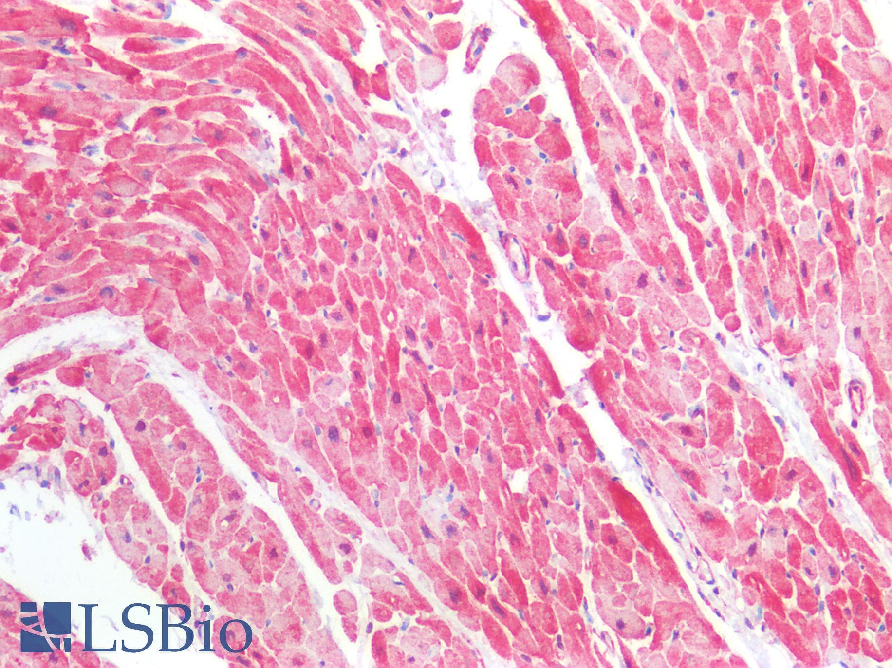 IHC-plus™ HSPB1 / HSP27 Antibody