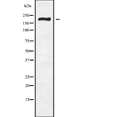 RBBP6 Antibody