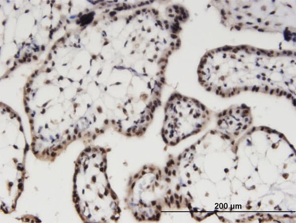 AIPL1 Antibody (clone 1E1)