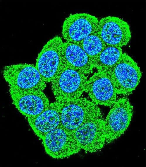 PM20D2 / ACY1L2 Antibody (aa396-425)