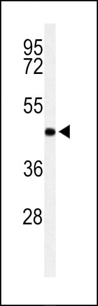 Polyclonal Rabbit anti-Human RPRD1B Antibody (aa254-282, WB)