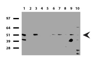 Monoclonal Mouse anti-Human SQSTM1 Antibody (clone UMAB12, Carrier-free, IHC, IF, WB)