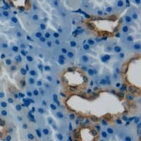 PRDX4 / Peroxiredoxin 4 Antibody