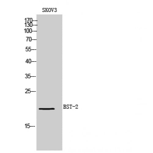 Polyclonal Rabbit anti-Human BST2 Antibody (101-150 aa, Internal, IHC, WB)