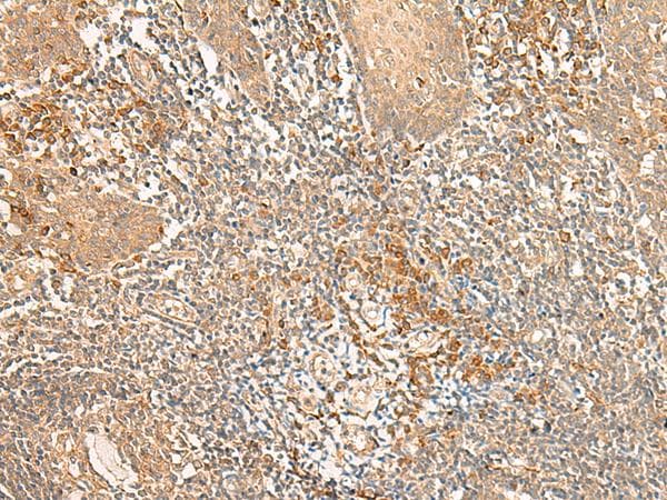 Polyclonal Rabbit anti-Human WLS / GPR177 Antibody (IHC)