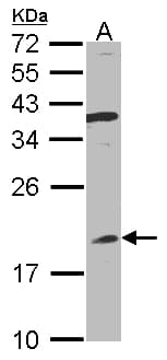IFNA8 / Interferon Alpha 8 Antibody (aa1-189)