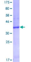 Human FCGRT / FCRN Protein (Recombinant GST, N-terminus)