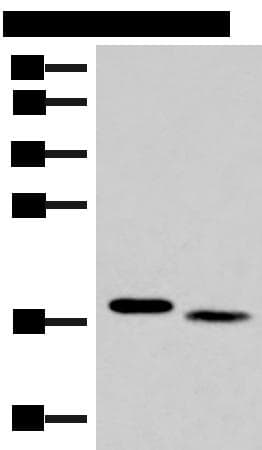 Polyclonal Rabbit anti-Human IL36A Antibody (IHC, WB)