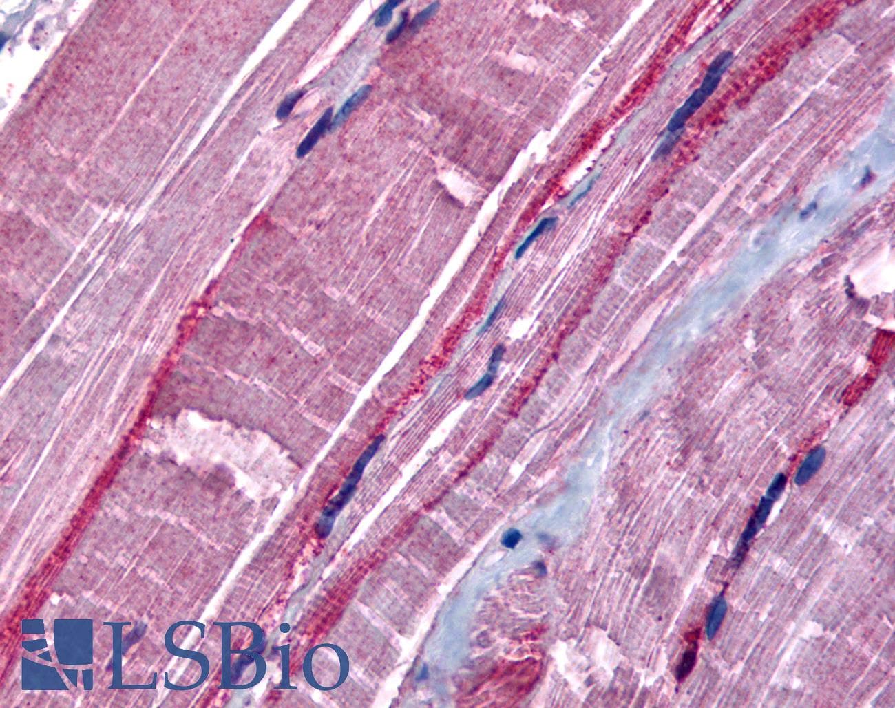 IHC-plus™ GRK5 Antibody (N-Terminus)