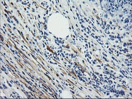 Monoclonal Mouse anti-Human CNN2 Antibody (clone OTI2B5, IHC, IF, WB)