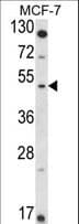 IHC-plus™ HSD2 / HSD11B2 Antibody (aa277-306)