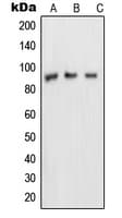 NUP88 Antibody (Internal)