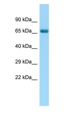 Polyclonal Rabbit anti-Human GRK6 Antibody (aa375-424, WB)