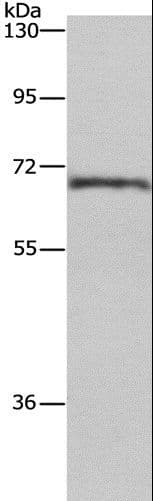 CDK5RAP3 Antibody