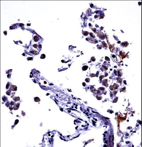 Polyclonal Rabbit anti-Human IL13 Antibody (aa118-146, IHC, IF, WB)