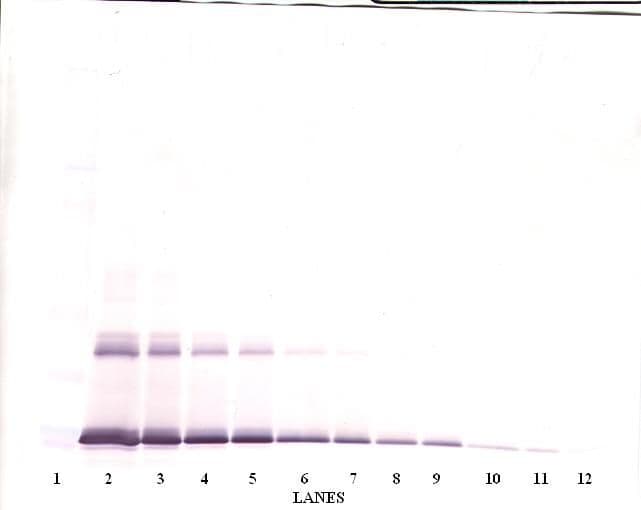 IL6 / Interleukin 6 Antibody