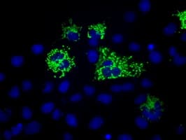HMRF1L / MTRF1L Antibody (clone OTI1E3)