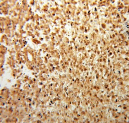 Polyclonal Rabbit anti-Human FGF2 / Basic FGF Antibody (IHC, WB)