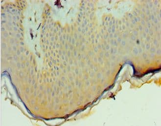 PNPLA3 / Adiponutrin Antibody (aa377-481)